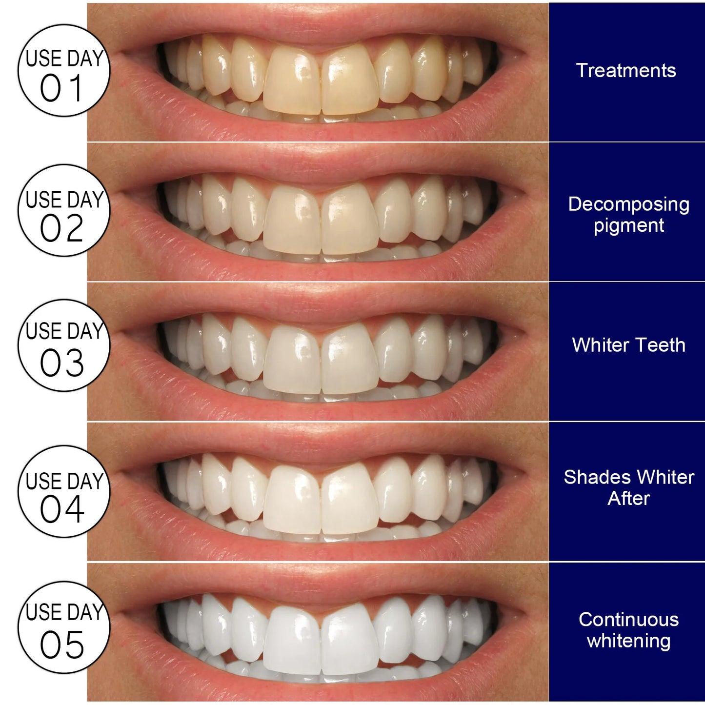 Teeth Whitening Strips Oral Hygiene Care Dental Bleaching Tooth Brightener