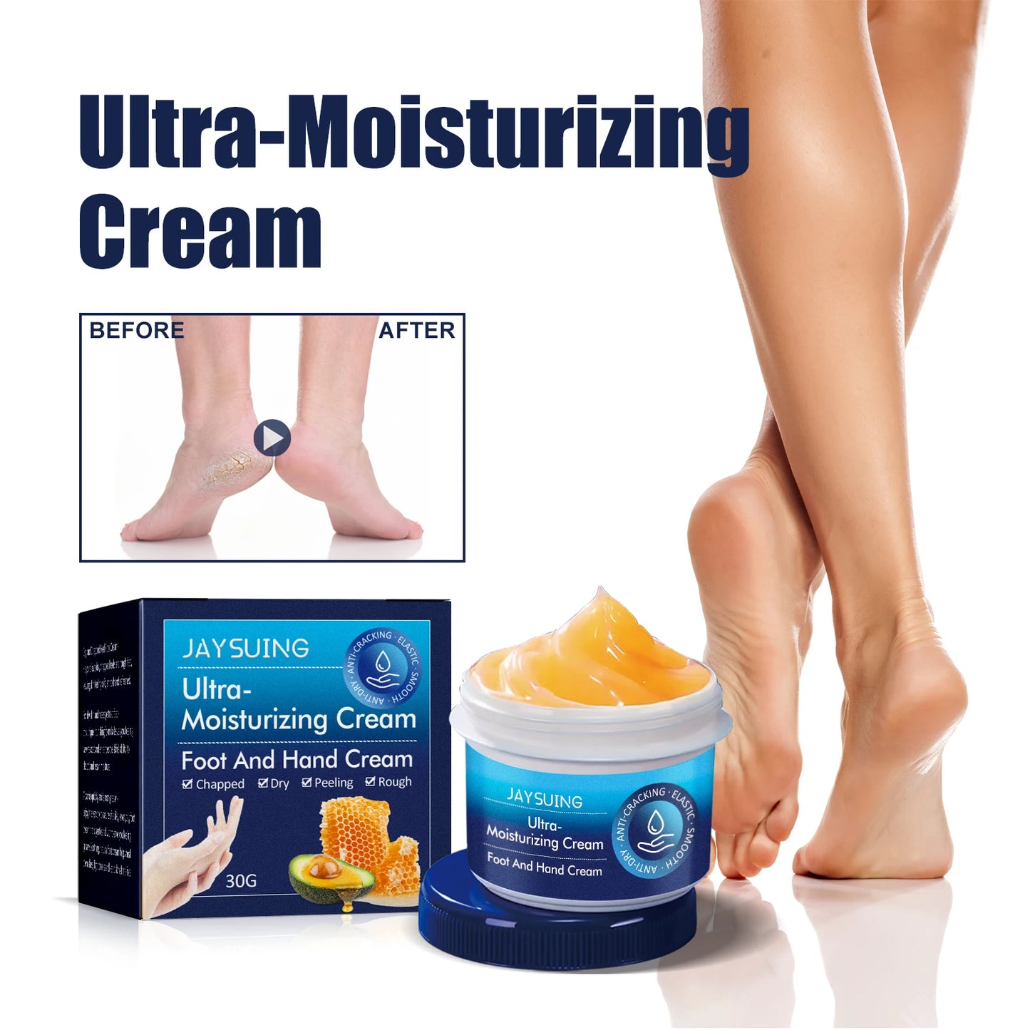Hydrating Nourishing Cream Peeling Dry itching Repair Anti-freeze Anti Chapping Foot And Hand Care Ultra Moisturizing Cream