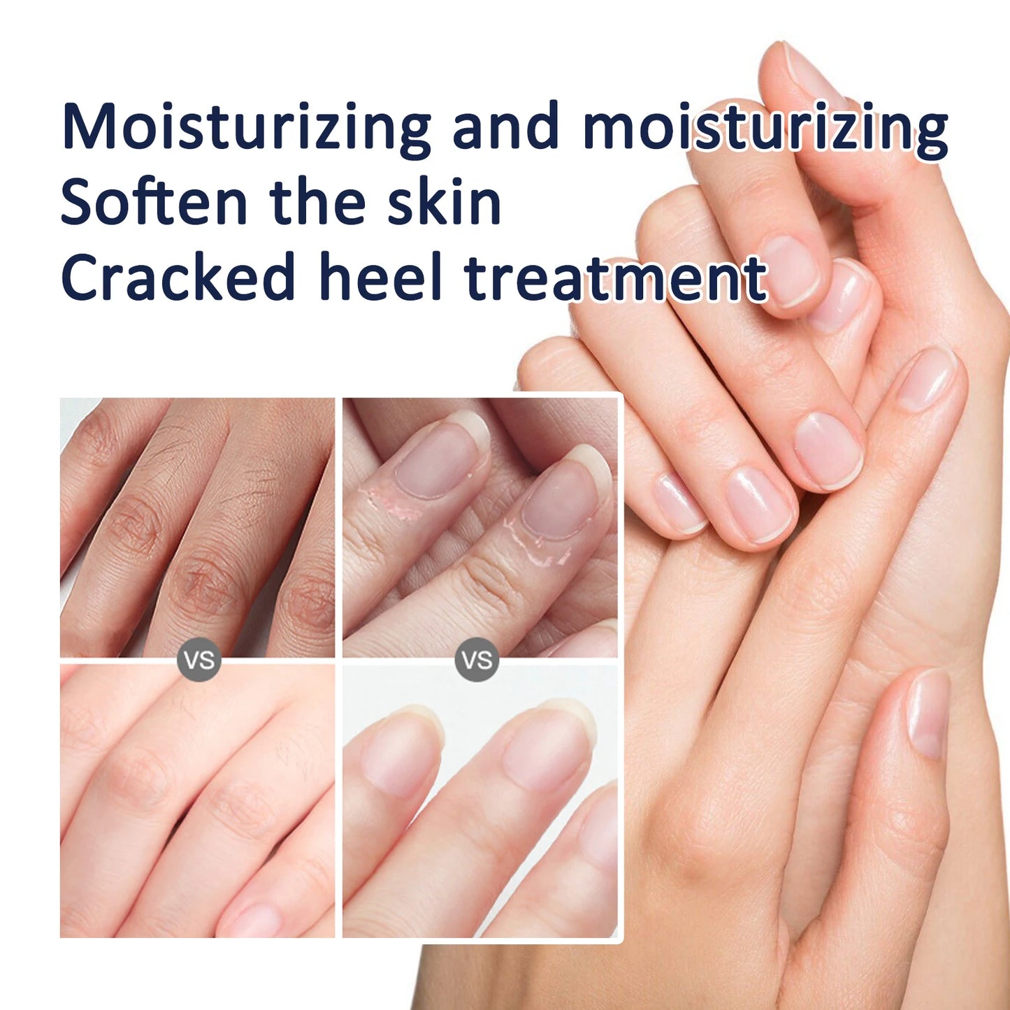 Hydrating Nourishing Cream Peeling Dry itching Repair Anti-freeze Anti Chapping Foot And Hand Care Ultra Moisturizing Cream
