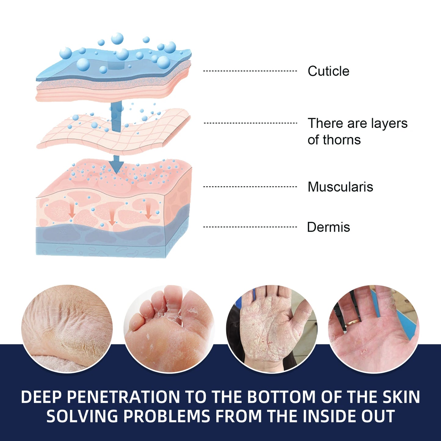 Hydrating Nourishing Cream Peeling Dry itching Repair Anti-freeze Anti Chapping Foot And Hand Care Ultra Moisturizing Cream
