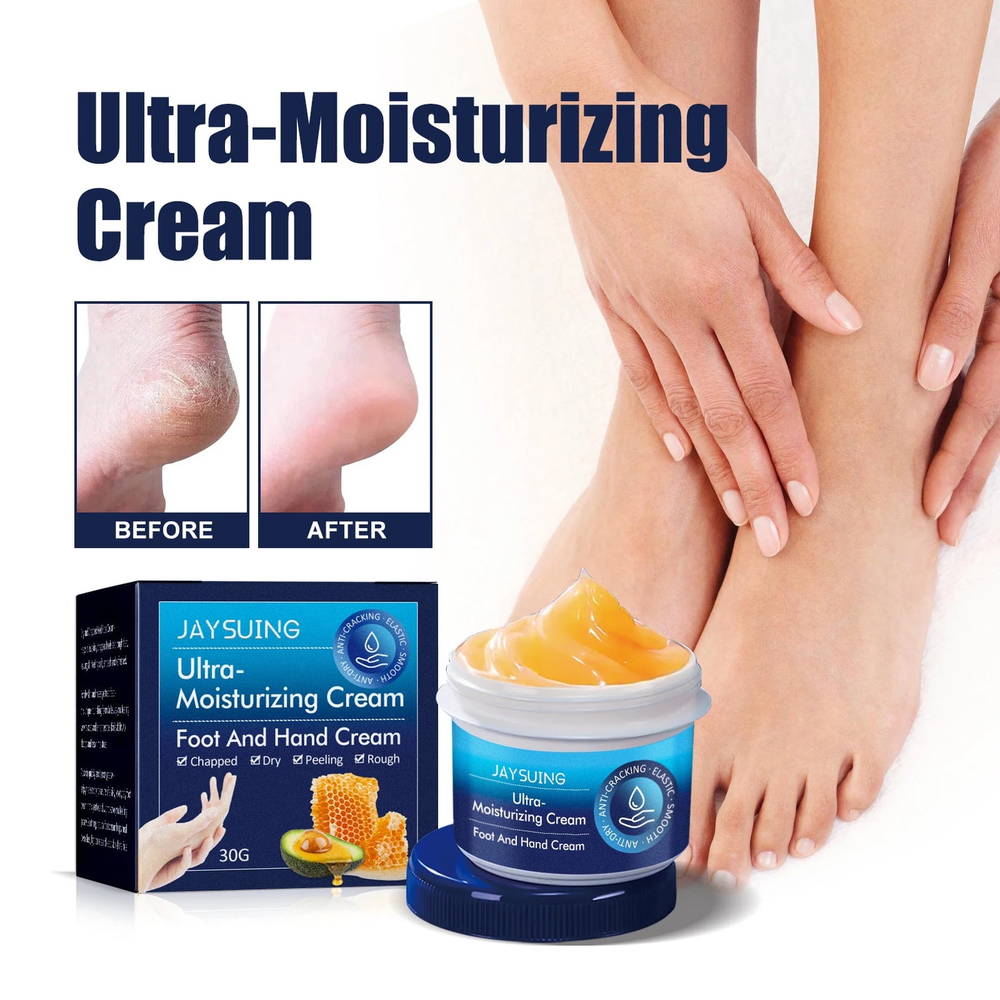 Hydrating Nourishing Cream Peeling Dry itching Repair Anti-freeze Anti Chapping Foot And Hand Care Ultra Moisturizing Cream