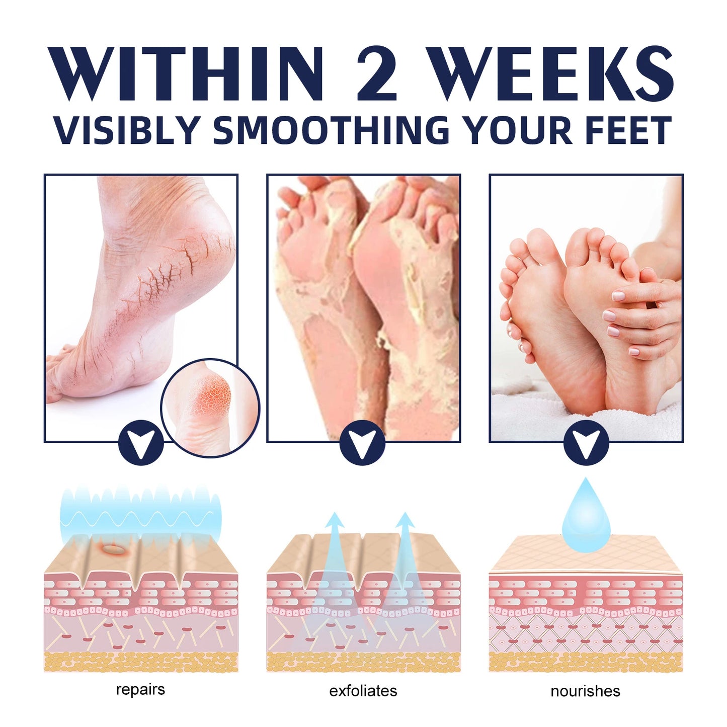 Hydrating Nourishing Cream Peeling Dry itching Repair Anti-freeze Anti Chapping Foot And Hand Care Ultra Moisturizing Cream