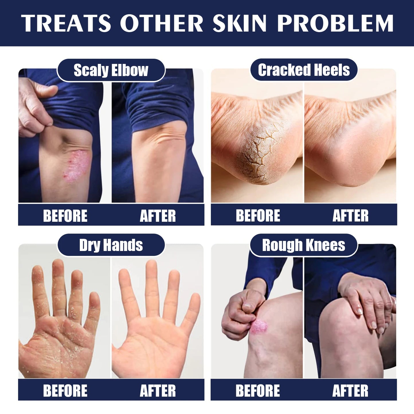 Hydrating Nourishing Cream Peeling Dry itching Repair Anti-freeze Anti Chapping Foot And Hand Care Ultra Moisturizing Cream