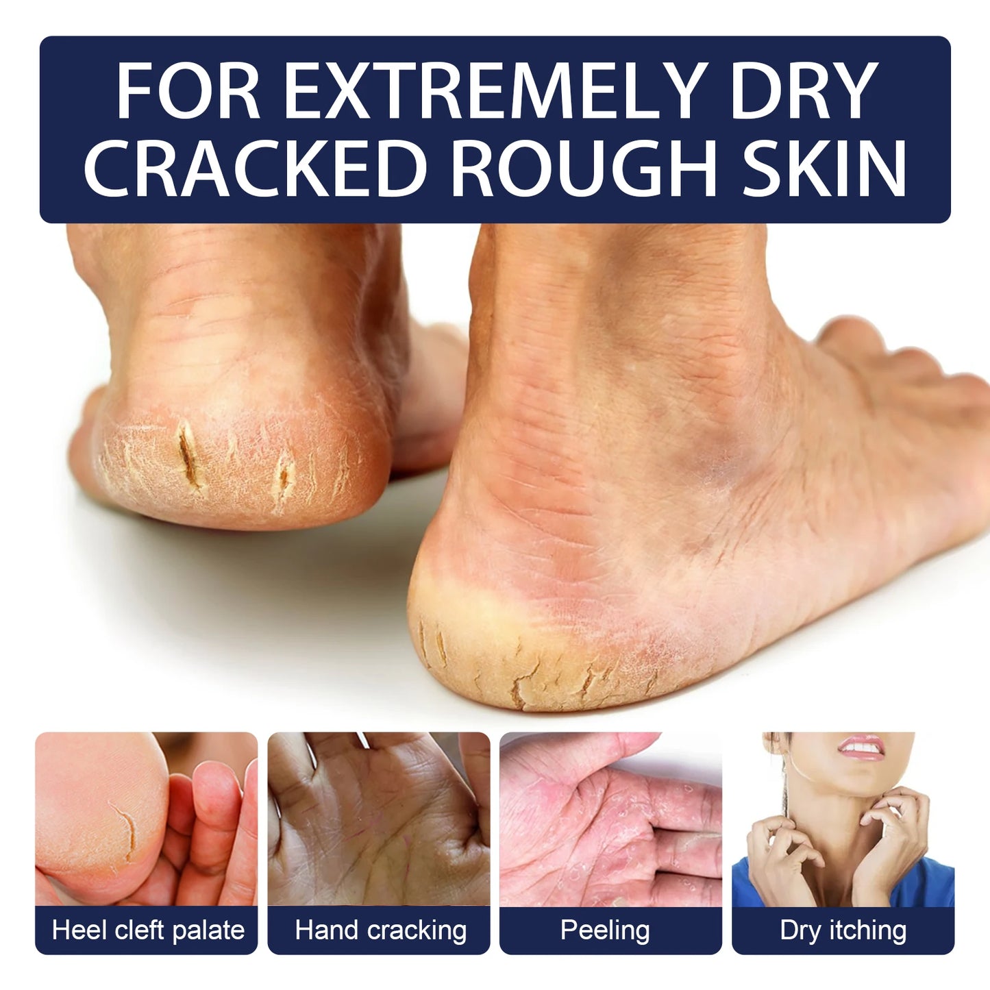 Hydrating Nourishing Cream Peeling Dry itching Repair Anti-freeze Anti Chapping Foot And Hand Care Ultra Moisturizing Cream