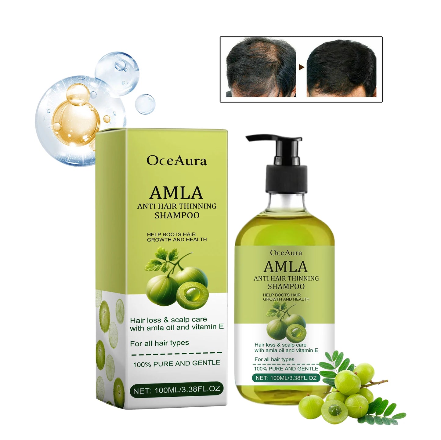 OceAura Anti Hair Thinning Shampoo Deeply Clean the Scalp Hair Moisturize the Scalp Prevent Dryness Anti Hair Thinning Shampoo