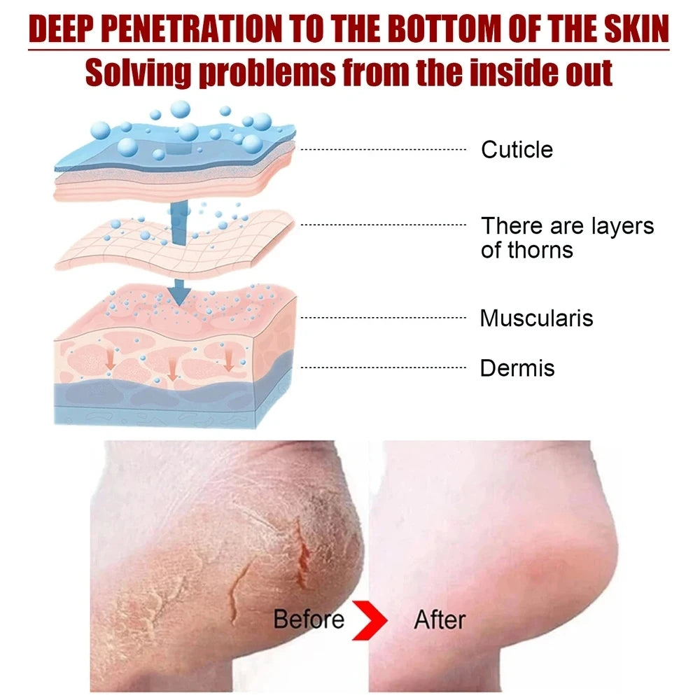 Peeling Foot Mask Repairs Heels & Removes Dry Dead Skin Feet Exfoliating Foot