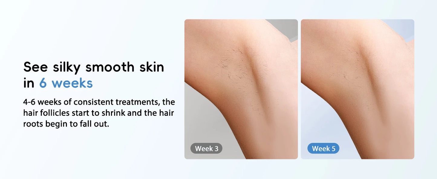 Hair Removal Laser IPL 22J Unlimted IGBT 5.2 cm² light Quick Flashes Painless Epilator Face Armpit Bikini Treament Boay Laser