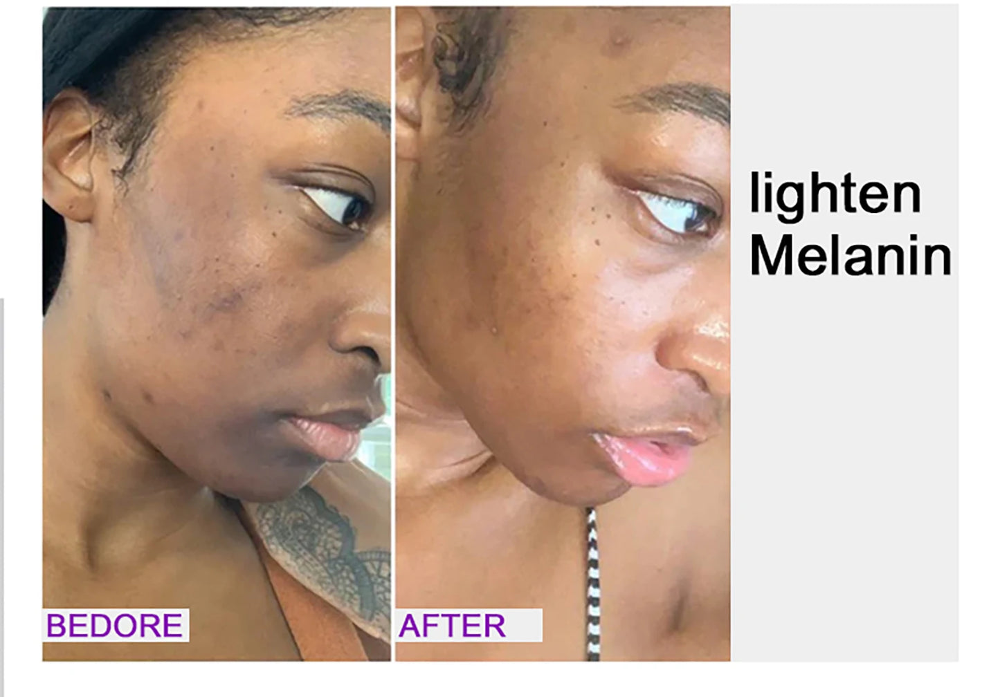 Whitening, Dark Spot & Sun Spot Removal Set, Brightening Shades, With Double Glutathione, Highly Concentrated Skin Care