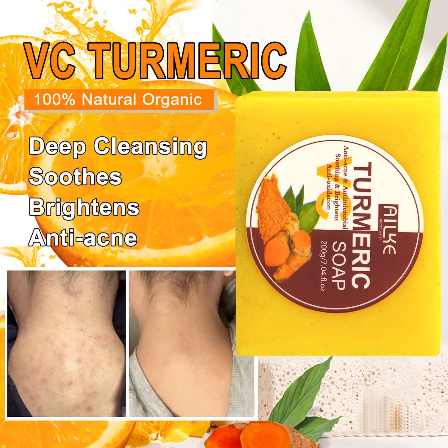 Organic Turmeric Skin Care Set,