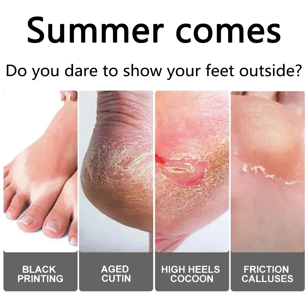 Peeling Foot Mask Repairs Heels & Removes Dry Dead Skin Feet Exfoliating Foot