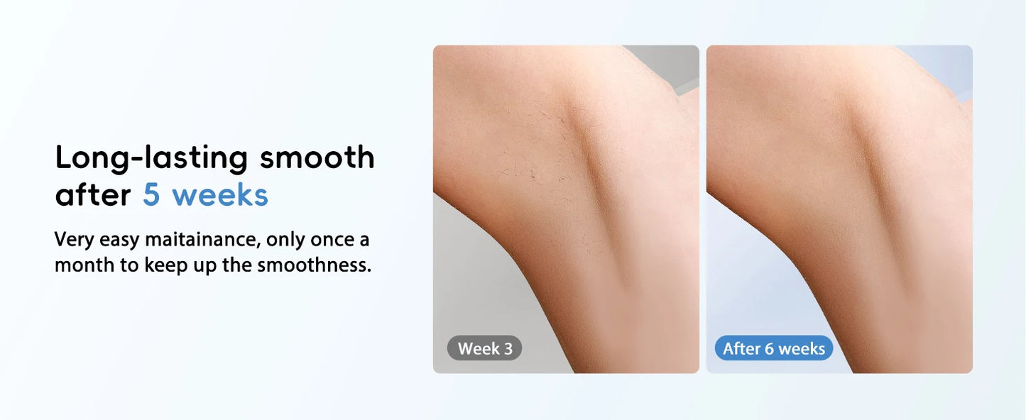 Hair Removal Laser IPL 22J Unlimted IGBT 5.2 cm² light Quick Flashes Painless Epilator Face Armpit Bikini Treament Boay Laser