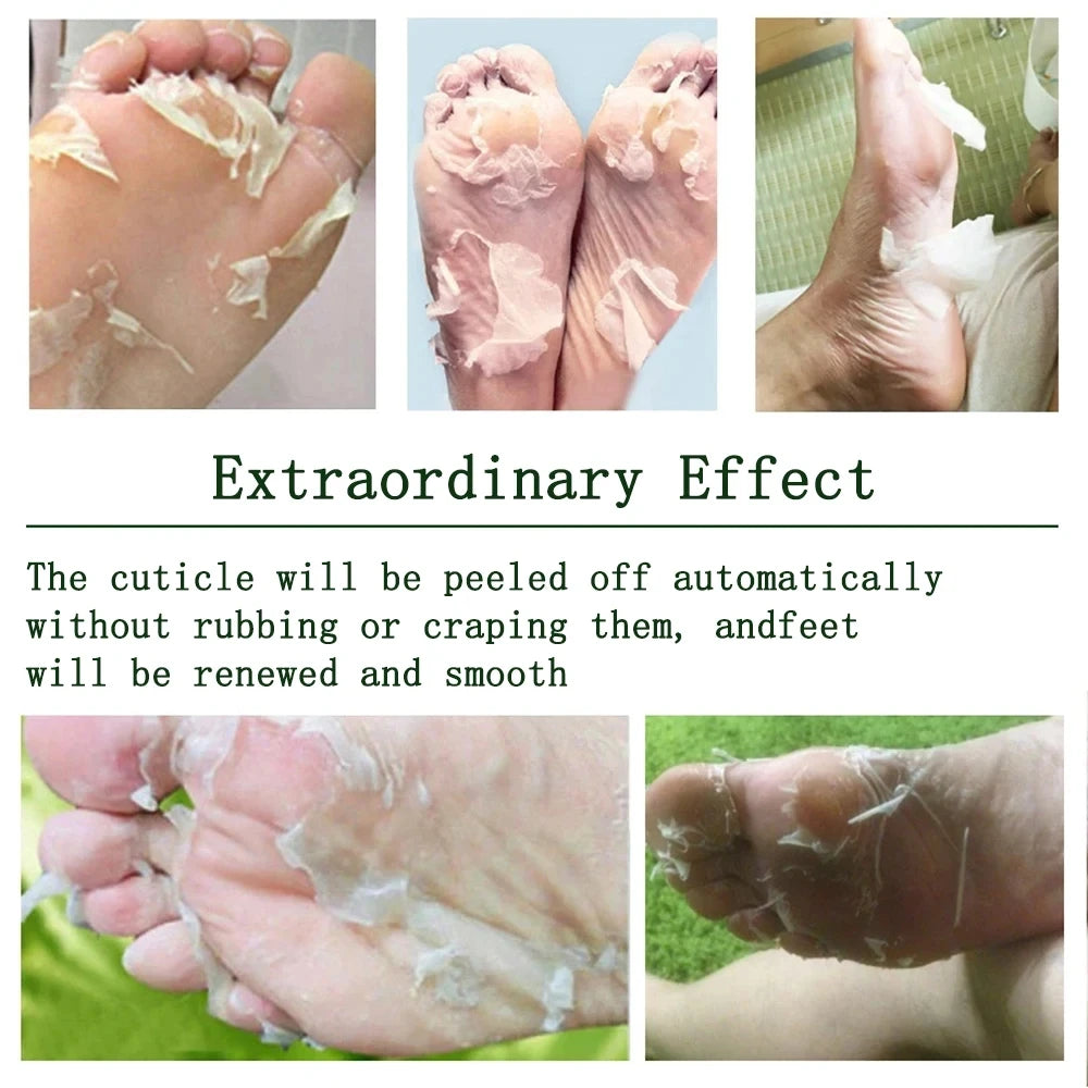 Peeling Foot Mask Repairs Heels & Removes Dry Dead Skin Feet Exfoliating Foot