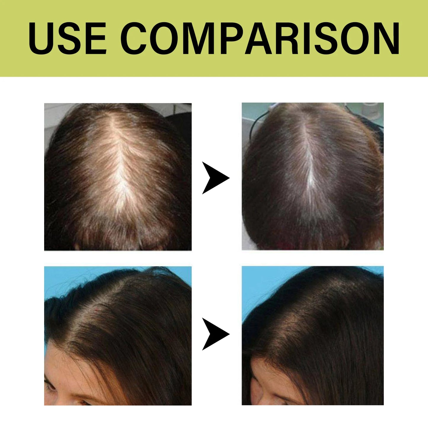 OceAura Anti Hair Thinning Shampoo Deeply Clean the Scalp Hair Moisturize the Scalp Prevent Dryness Anti Hair Thinning Shampoo