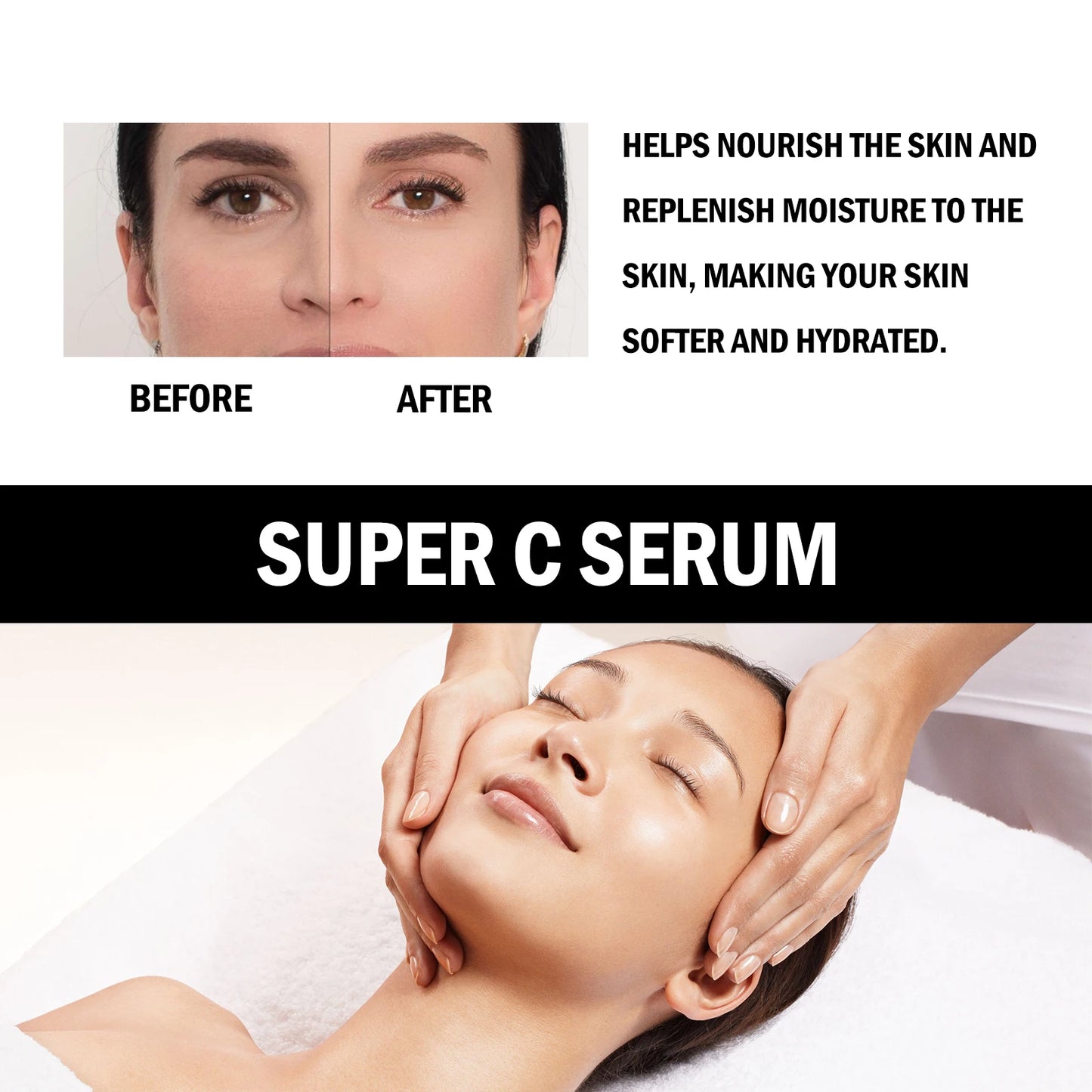 Vitamin C Serum For Face Dark Spot Removal Niacinamide Moisturizing