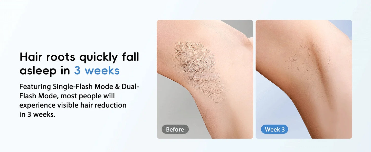 Hair Removal Laser IPL 22J Unlimted IGBT 5.2 cm² light Quick Flashes Painless Epilator Face Armpit Bikini Treament Boay Laser