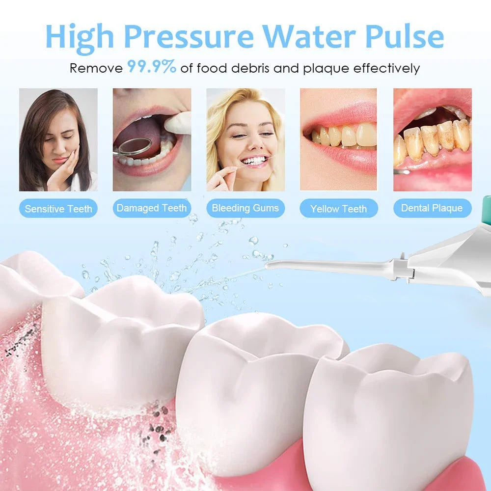 Oral Water Jet Flosser Dental Irrigator Teeth Whitening Portable Water Flosser