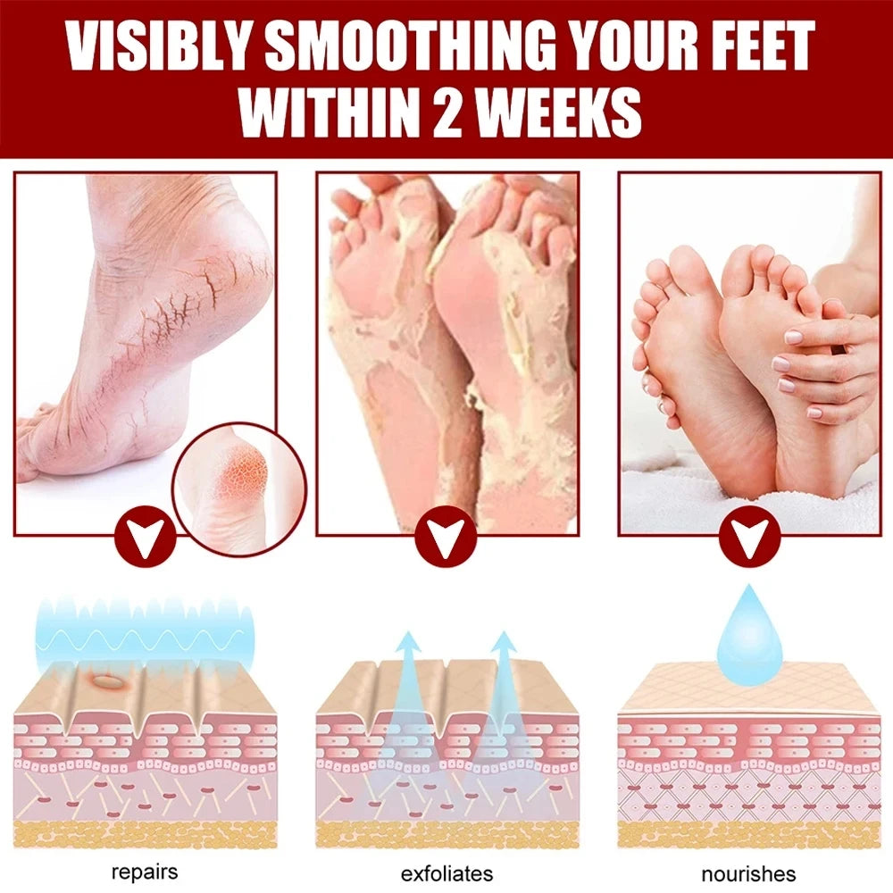 Peeling Foot Mask Repairs Heels & Removes Dry Dead Skin Feet Exfoliating Foot