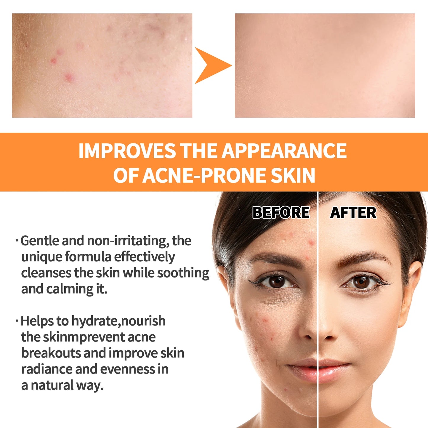 Turmeric Skin Care Original Face Cream Serum Oil Stick Mask Body Whitening Anti Acne Lighten Dark Spot Moisturizing