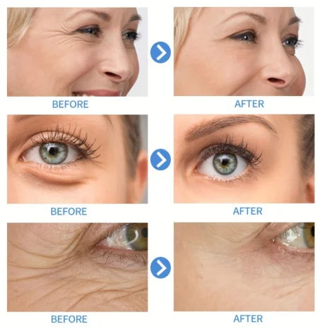 15ml Hyaluronic Acid Propylene Glycol Facial Essence Facial Lifting Collagen Essence Skin Care
