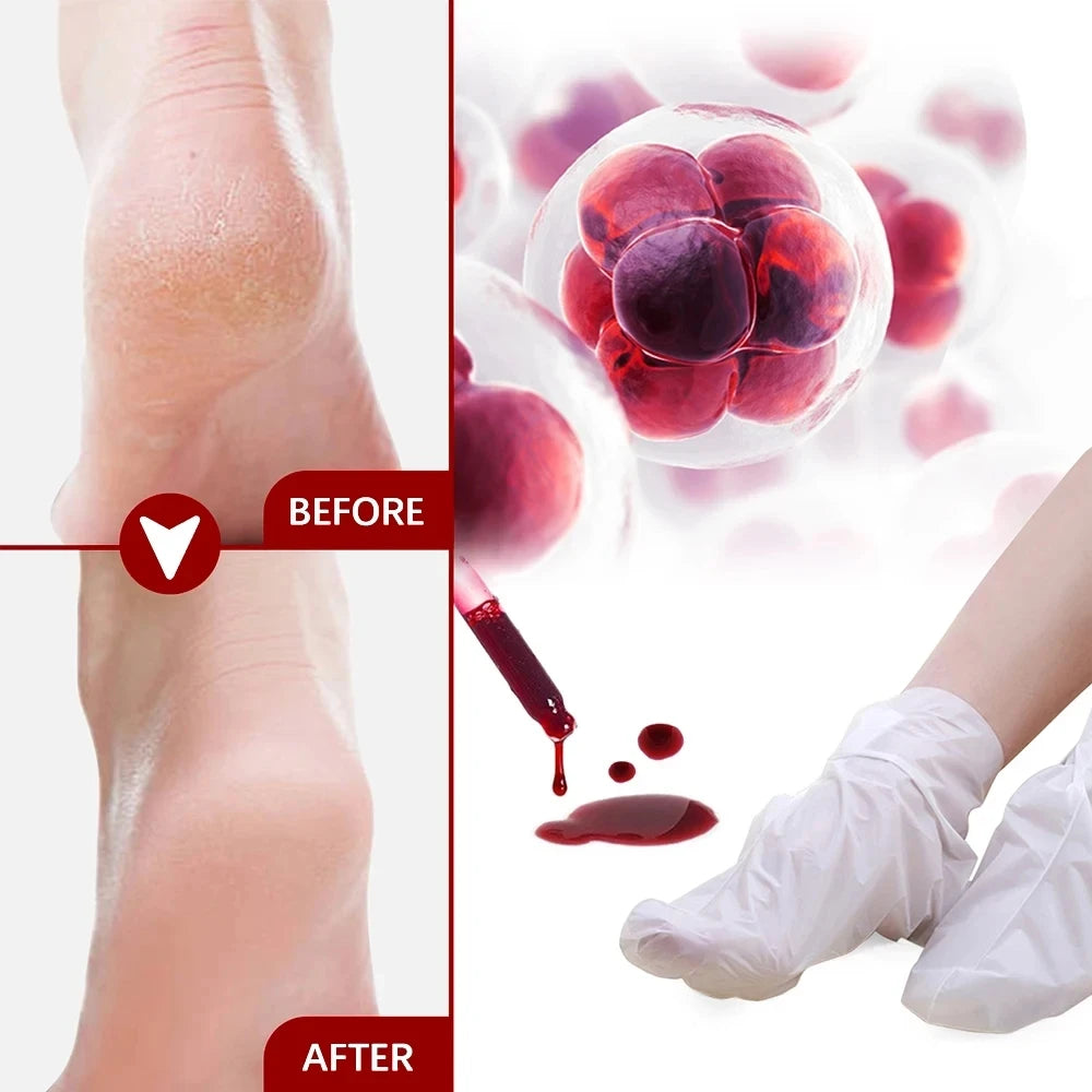 Peeling Foot Mask Repairs Heels & Removes Dry Dead Skin Feet Exfoliating Foot