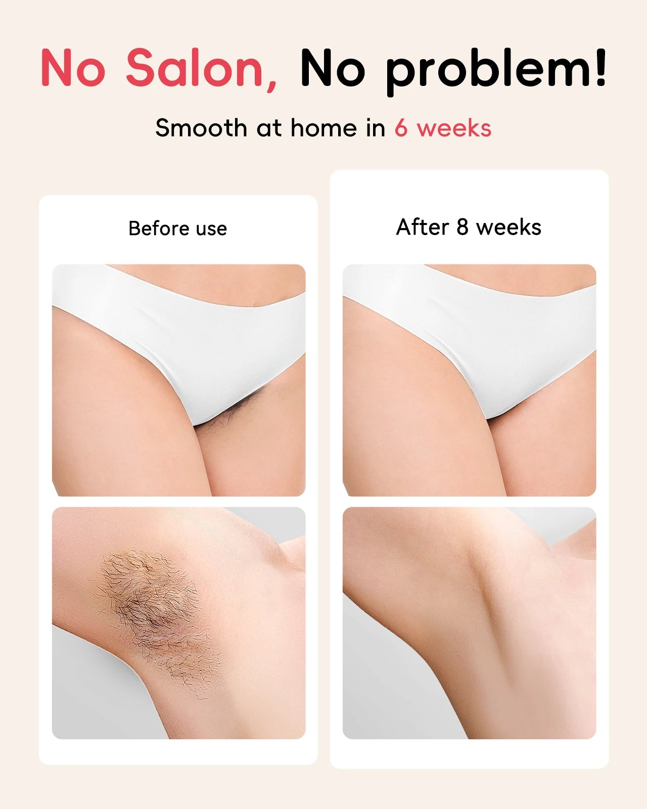 Hair Removal Laser IPL 22J Unlimted IGBT 5.2 cm² light Quick Flashes Painless Epilator Face Armpit Bikini Treament Boay Laser