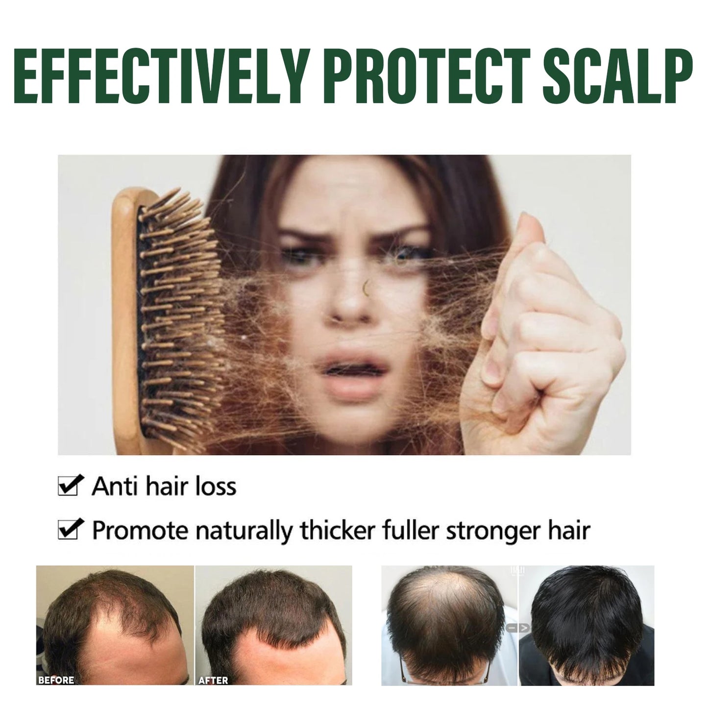 OceAura Anti Hair Thinning Shampoo Deeply Clean the Scalp Hair Moisturize the Scalp Prevent Dryness Anti Hair Thinning Shampoo