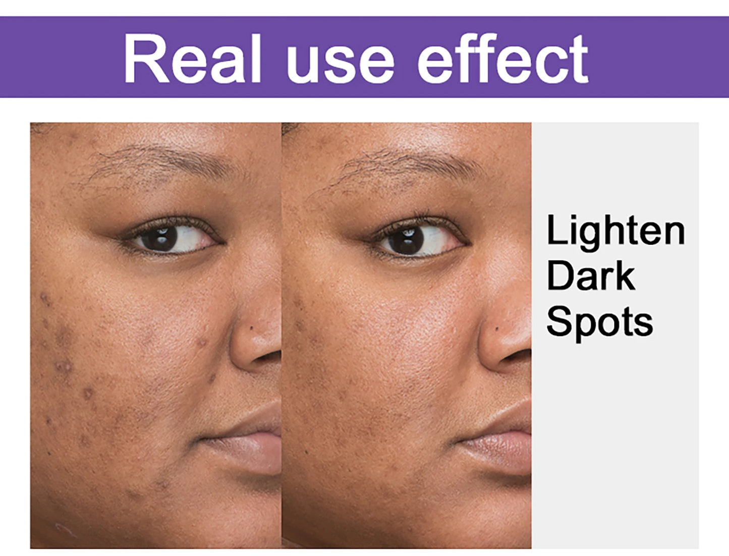 Whitening, Dark Spot & Sun Spot Removal Set, Brightening Shades, With Double Glutathione, Highly Concentrated Skin Care