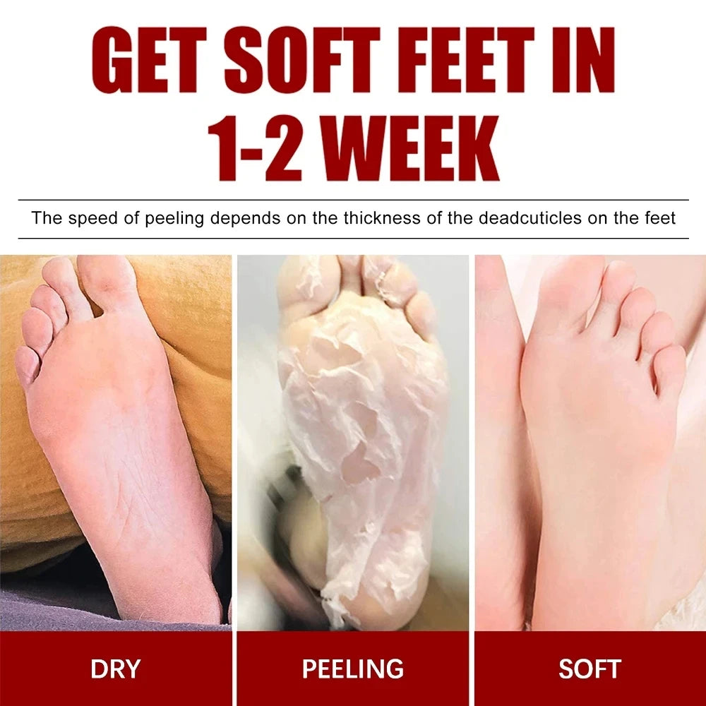 Peeling Foot Mask Repairs Heels & Removes Dry Dead Skin Feet Exfoliating Foot
