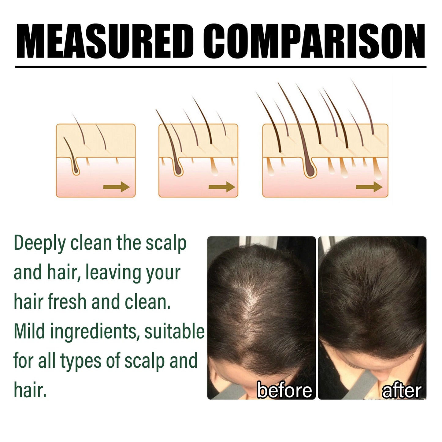 OceAura Anti Hair Thinning Shampoo Deeply Clean the Scalp Hair Moisturize the Scalp Prevent Dryness Anti Hair Thinning Shampoo