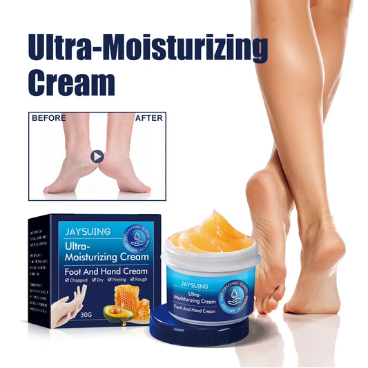 Hydrating Nourishing Cream Peeling Dry itching Repair Anti-freeze Anti Chapping Foot And Hand Care Ultra Moisturizing Cream