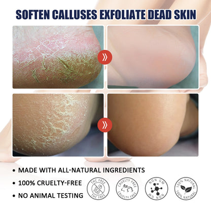 Hydrating Nourishing Cream Peeling Dry itching Repair Anti-freeze Anti Chapping Foot And Hand Care Ultra Moisturizing Cream
