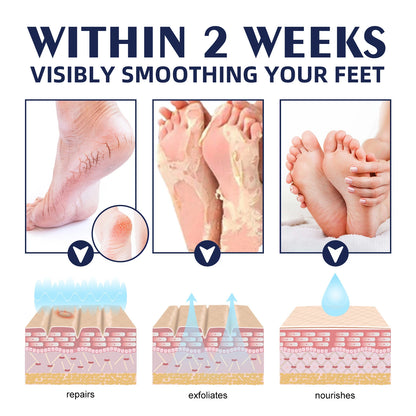 Hydrating Nourishing Cream Peeling Dry itching Repair Anti-freeze Anti Chapping Foot And Hand Care Ultra Moisturizing Cream