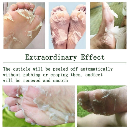 Peeling Foot Mask Repairs Heels & Removes Dry Dead Skin Feet Exfoliating Foot