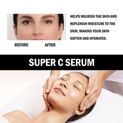 Vitamin C Serum For Face Dark Spot Removal Niacinamide Moisturizing