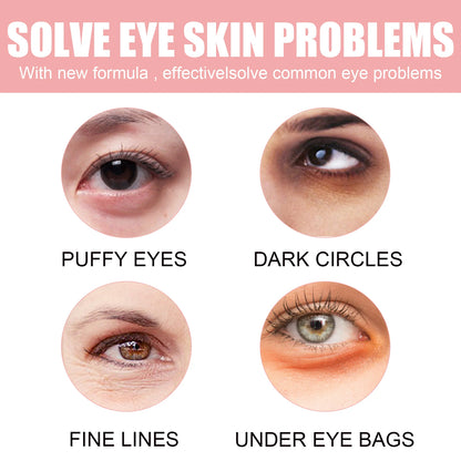 60pcs Rose Eye Mask Fades Fine Lines, Eye Bags, Dark Circles