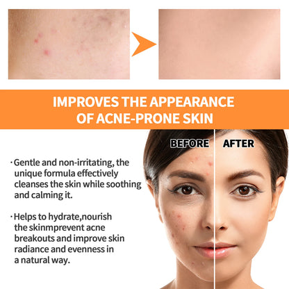 Turmeric Skin Care Original Face Cream Serum Oil Stick Mask Body Whitening Anti Acne Lighten Dark Spot Moisturizing