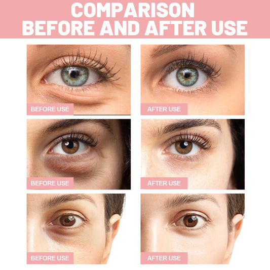 60pcs Rose Eye Mask Fades Fine Lines, Eye Bags, Dark Circles