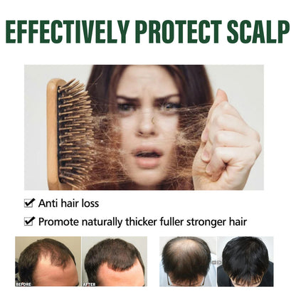 OceAura Anti Hair Thinning Shampoo Deeply Clean the Scalp Hair Moisturize the Scalp Prevent Dryness Anti Hair Thinning Shampoo