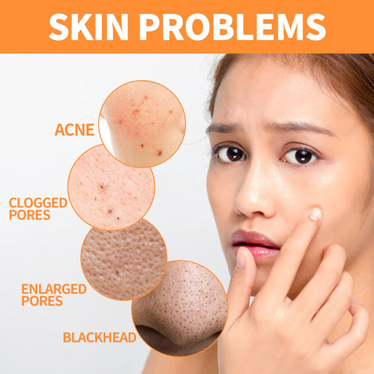 Turmeric Skin Care Original Face Cream Serum Oil Stick Mask Body Whitening Anti Acne Lighten Dark Spot Moisturizing