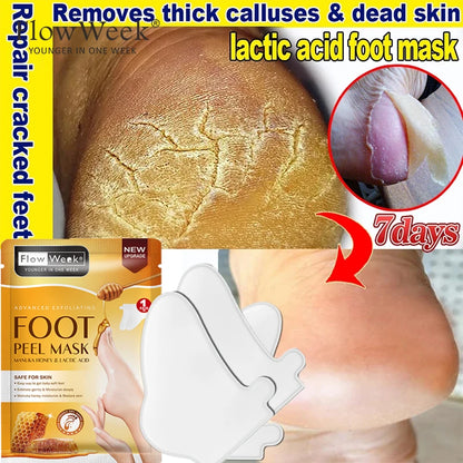 Peeling Foot Mask Repairs Heels & Removes Dry Dead Skin Feet Exfoliating Foot