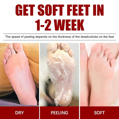 Peeling Foot Mask Repairs Heels & Removes Dry Dead Skin Feet Exfoliating Foot